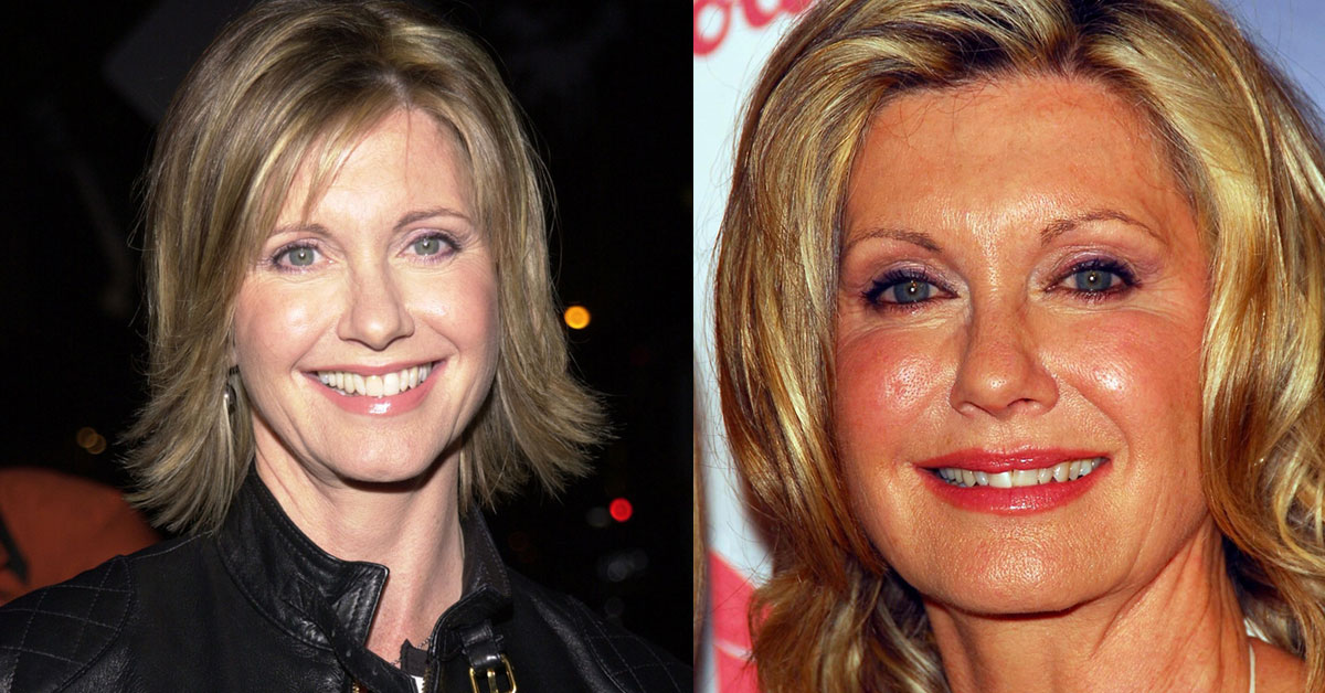 Olivia Newton-John dies at age 73