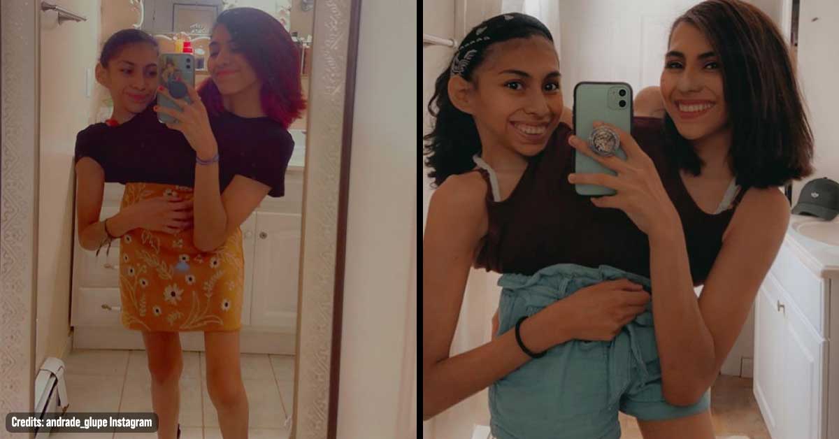 Conjoined Twins Talk About Meeting Their Romantic Partners