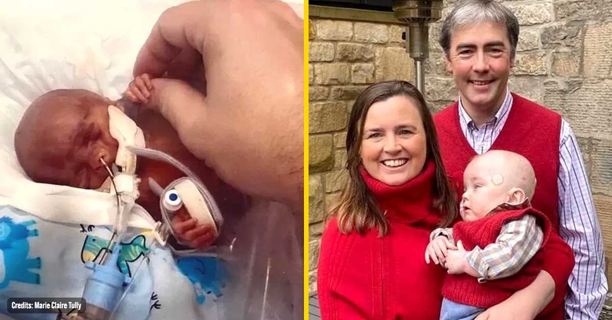 Baby who was Given Just ONE Day to Live Reaches FIRST Birthday