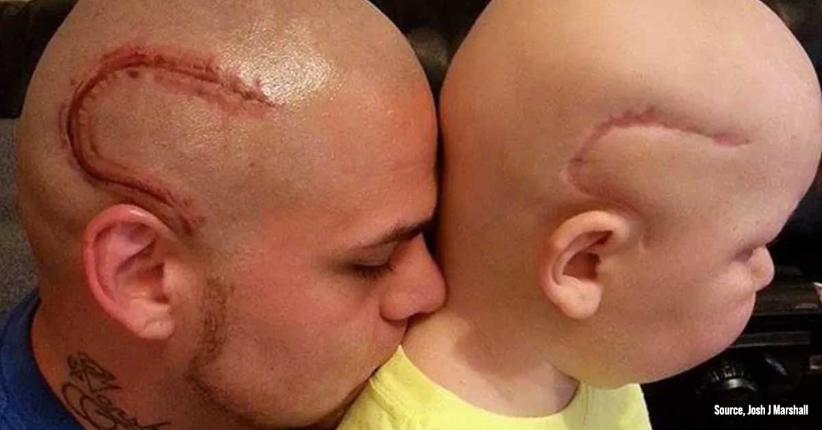 Kansas Dad Got Tattooed so His Son with Cancer Won’t Feel Low on Self Confidence