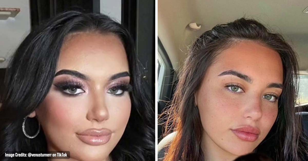 Woman Praised for Ditching Heavy Makeup, Lip Fillers, and Fake Lashes