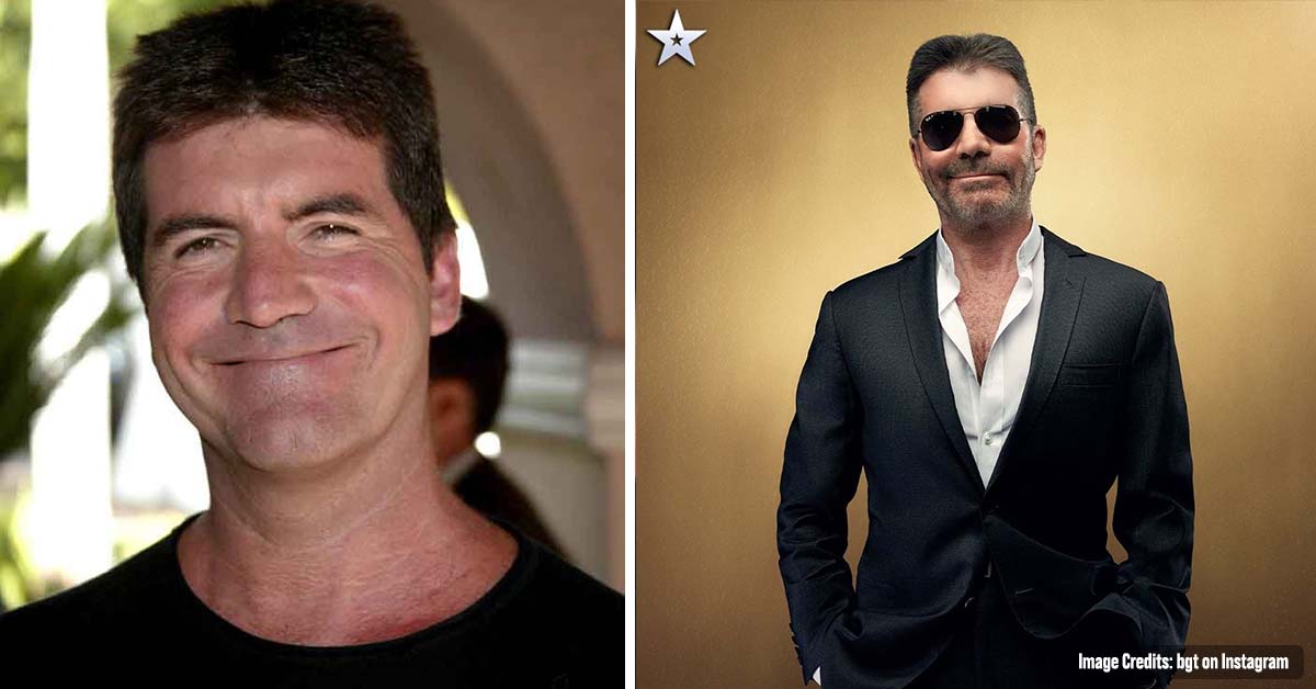 Simon Cowell Finally Addresses Plastic Surgery Rumors