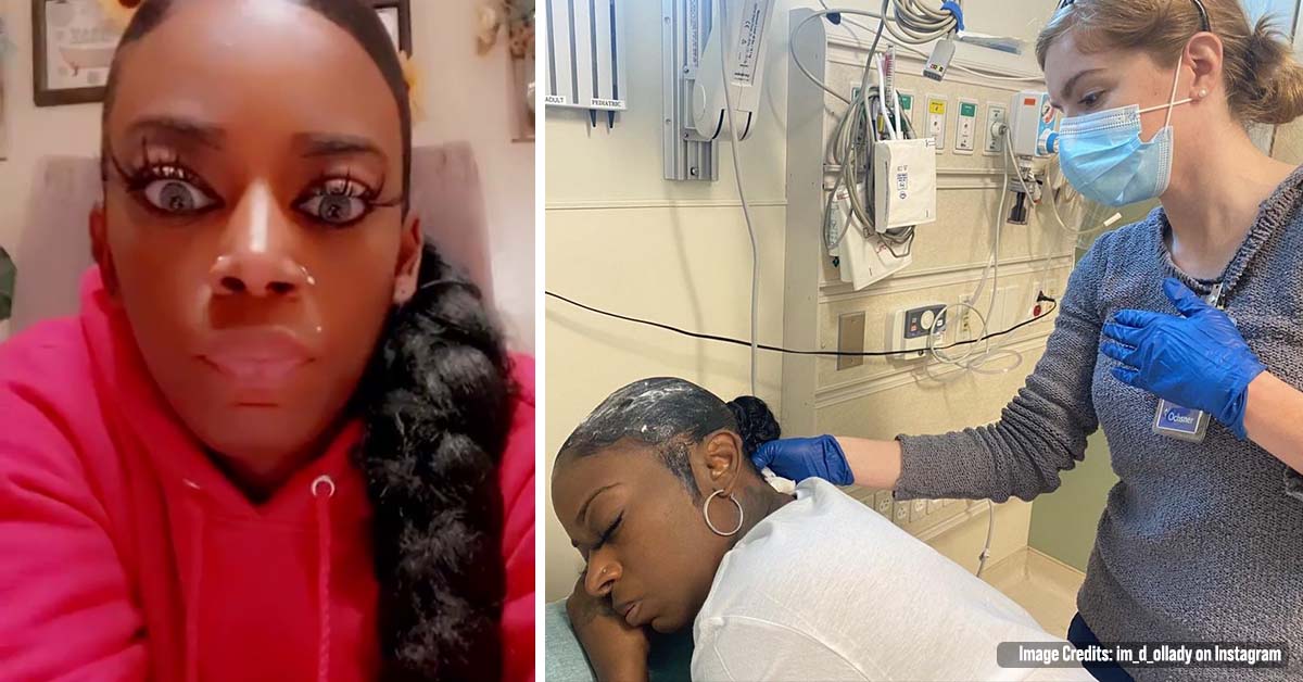 Woman Who Used Gorilla Glue Instead of Hair Setting Spray Ended Up in the Hospital