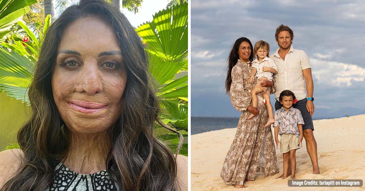 Turia Pitt, 35, Who Was Almost Killed in a Horrific Bushfire During an Ultramarathon, is a Now Happy Mum of Two