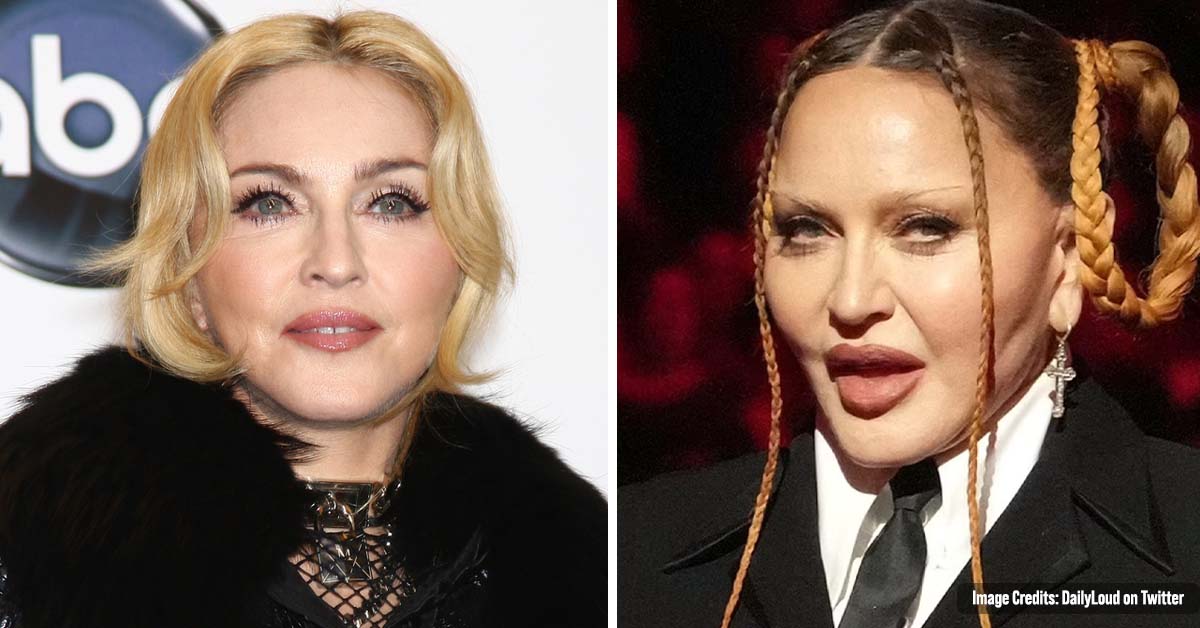 Madonna, 64, had been deeply affected by ‘Harsh Criticism’ of her Changing Face and Wants to ‘Look more like her Old Self’