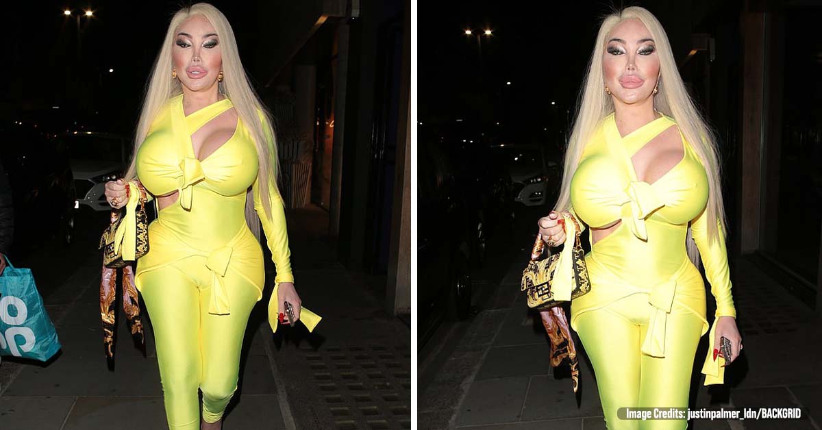TV Star Shows off Her Incredible $1 Million Plastic Surgery Transformation