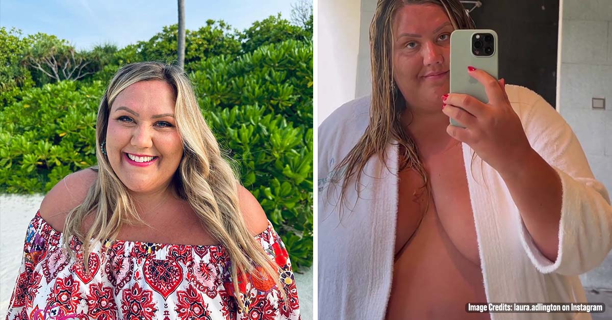 Bake Off Star Laura Adlington Goes Topless as She Slams ‘Fancy Spas’ for Excluding Plus Size Guests