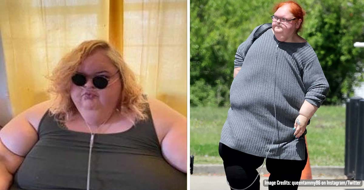 ‘1000-lb Sisters’ Star Tammy Slaton Praised After She’s Seen Walking ‘Unassisted’ Following Weight Loss Surgery