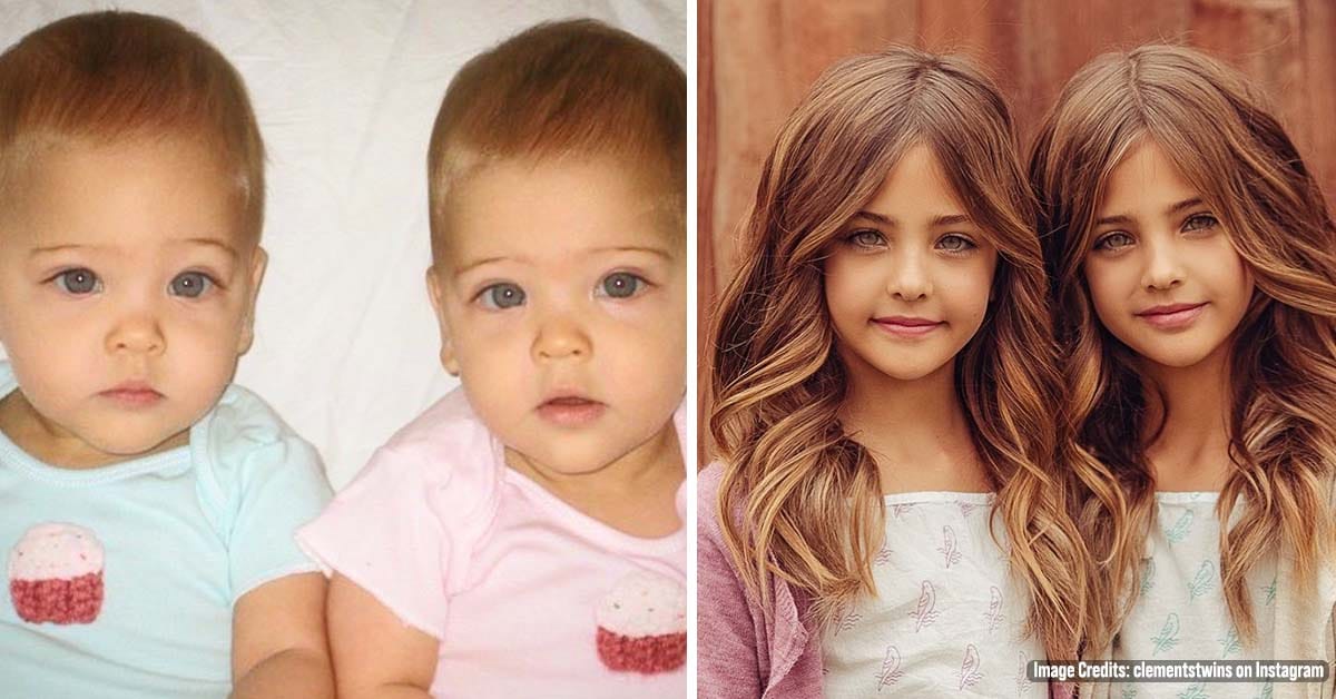 Years Ago They Were Called ‘The World’s Most Beautiful Twins’ – Now Look at Them