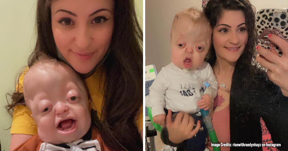 Every time She Posts Pictures of Her Baby Online, People Beg Her to Stop