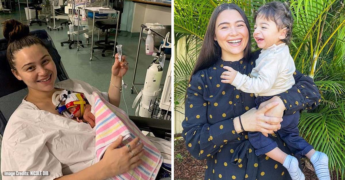 Mum Refuses to Turn Premature Baby’s Life Support Off