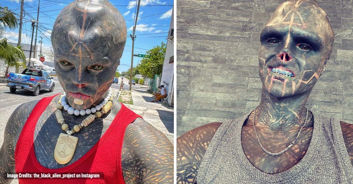‘Black Alien’ Considers Leg Amputation Following Ear, Lip, and Finger Procedures